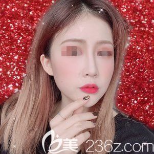 剛注射完瘦臉術(shù)后4天 剛注射完瘦臉術(shù)后4天