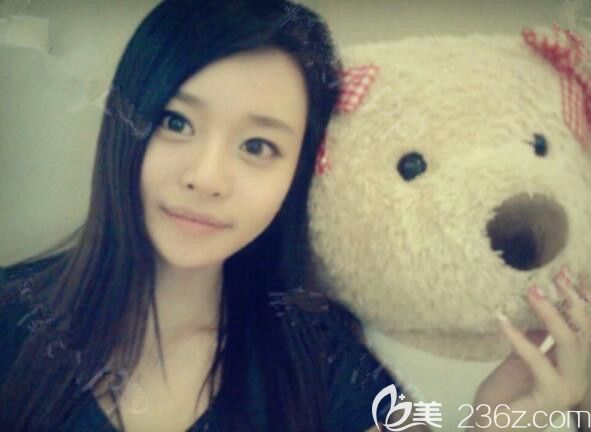 下巴太長太寬在韓國綺林整形外科做了下巴T型截骨縮小寬下巴我的氣質(zhì)提升了一個(gè)檔次