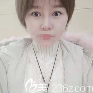 鄭州菲林駱豫醫(yī)生做玻尿酸填充下巴術(shù)后2天