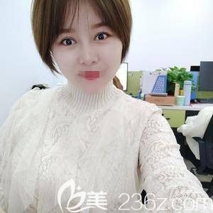 鄭州菲林駱豫醫(yī)生做玻尿酸填充下巴術(shù)后11天