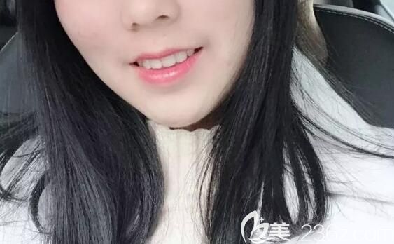 堅信深覆合千萬不要矯正的小伙伴，不妨來看看我在聊城領航口腔矯正深覆合的效果圖