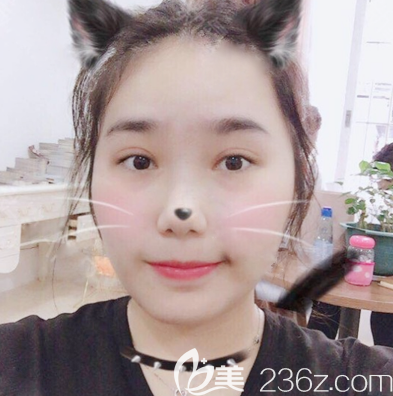 去東莞壹加壹整形醫(yī)院找梅小霞割完雙眼皮后拿到一份雙眼皮價(jià)格表