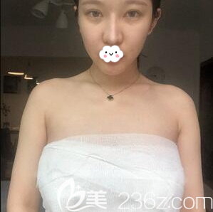 <i data-id='d9dbea55-b0dd-4d91-b9a3-14b0ee59b540' style='display:none;'></i>王家勇隆胸術(shù)后即刻照片 <i data-id='d9dbea55-b0dd-4d91-b9a3-14b0ee59b540' style='display:none;'></i>王家勇隆胸術(shù)后即刻照片