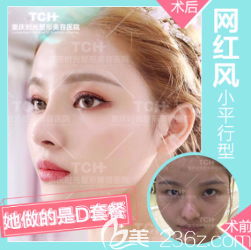 重慶時光割雙眼皮怎么樣