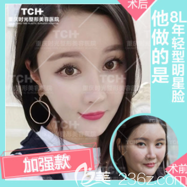 重慶時光整形面部線雕 重慶時光整形面部線雕