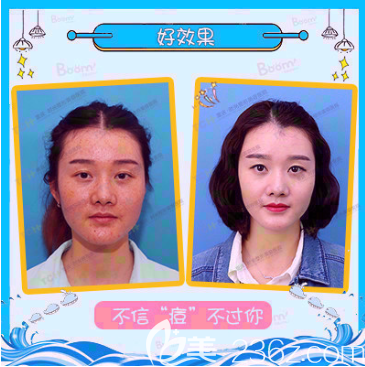 重慶時光整形祛斑祛痘 重慶時光整形祛斑祛痘