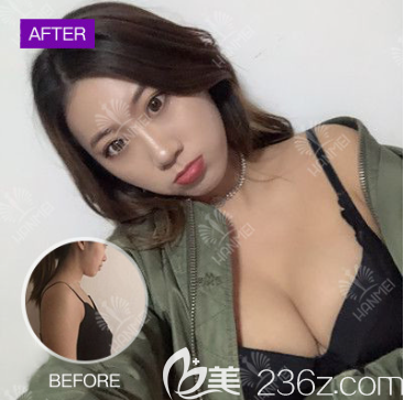 太全面！您有一份遵義韓美整形價格和隆胸吸脂祛斑等案例效果圖，請查收。