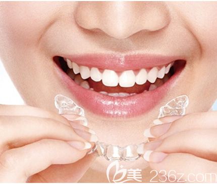 洛陽九龍口腔劉春麗介紹時代天使隱形雙模和單模的區(qū)別