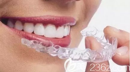 洛陽九龍口腔李世軒醫(yī)生介紹隱形牙齒矯正優(yōu)勢 洛陽九龍口腔李世軒醫(yī)生介紹隱形牙齒矯正優(yōu)勢