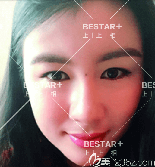 北京上上相蜂巢明星藝術(shù)面雕和雙眼皮案例 北京上上相蜂巢明星藝術(shù)面雕和雙眼皮案例