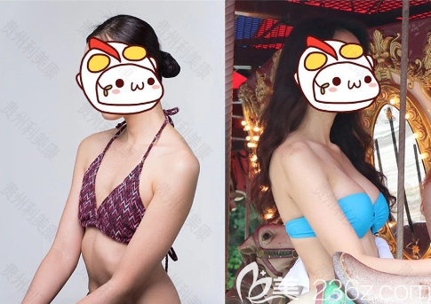 貴州利美康口碑怎么樣