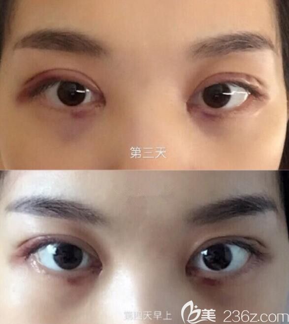 20190611_1560240896357554.jpg 20190611_1560240896357554.jpg