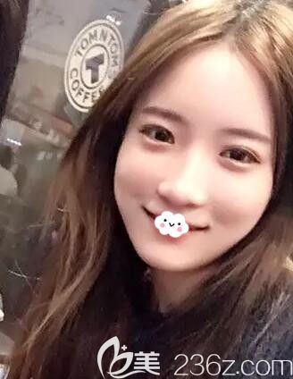 有人說外切眼袋后悔死了，我找韓國歐米茄整形醫(yī)院做晶透下眼皮整形去眼袋+黑眼圈后擁有臥蠶