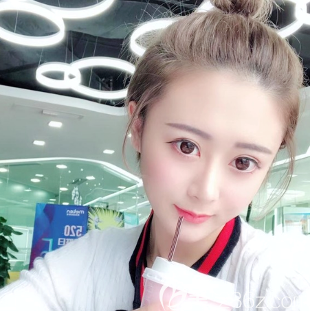 廣州中家醫(yī)家庭醫(yī)生朱云做脂肪填充<span style=