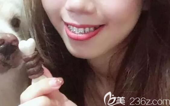 在<!--<i data=20240703-sp></i>-->雅悅口腔做矯正中 在<!--<i data=20240703-sp></i>-->雅悅口腔做矯正中