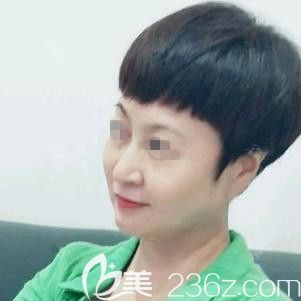 趙彥光醫(yī)生為我做埋線提升術(shù)后10天面部皮膚緊致 趙彥光醫(yī)生為我做埋線提升術(shù)后10天面部皮膚緊致