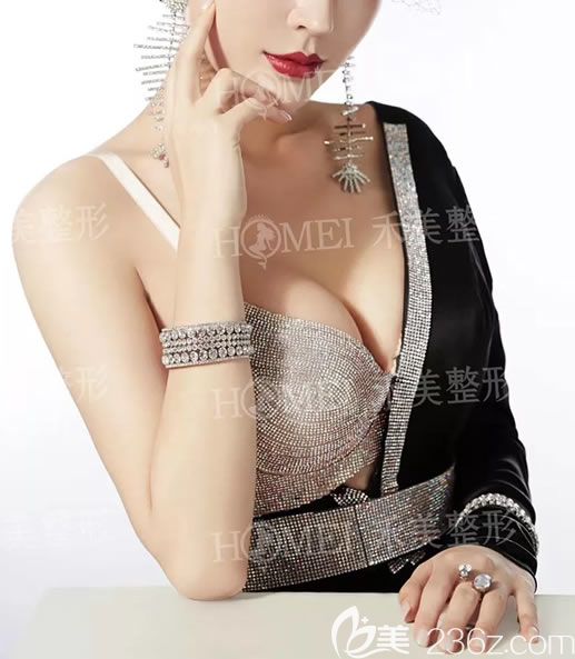 嘉興禾美做隆胸怎么樣?2個(gè)月前找曹海峰醫(yī)生做了假體隆胸的我有話說