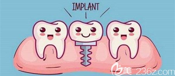 關(guān)于種植牙的一些小常識