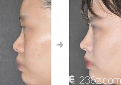 20190613_1560395933586454.png image.png