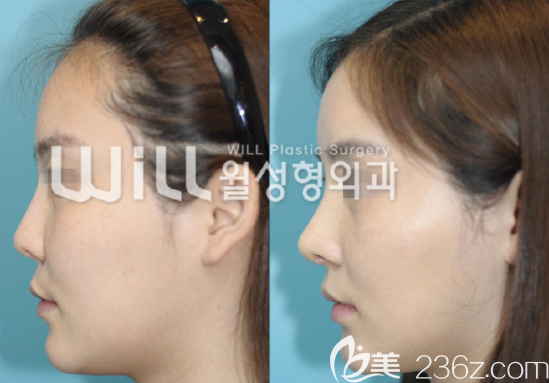 魏亨坤案例 魏亨坤案例