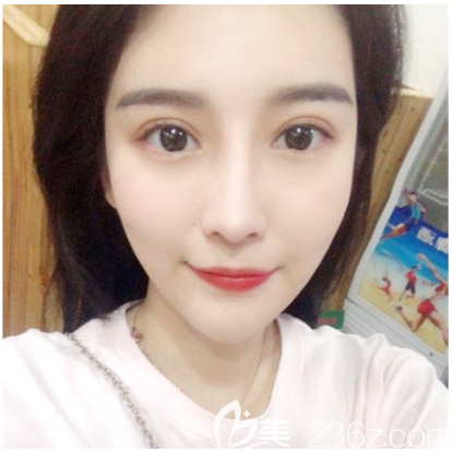 中信惠州醫(yī)院整形美容科做雙眼皮怎么樣 中信惠州醫(yī)院整形美容科做雙眼皮怎么樣