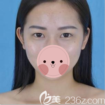 在宜賓韓美做眼睛前內(nèi)雙特別厲害 在宜賓韓美做眼睛前內(nèi)雙特別厲害