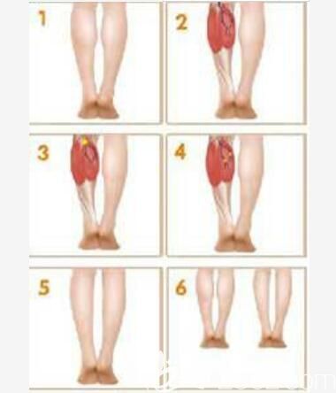 瘦腿即是A型除皺針劑