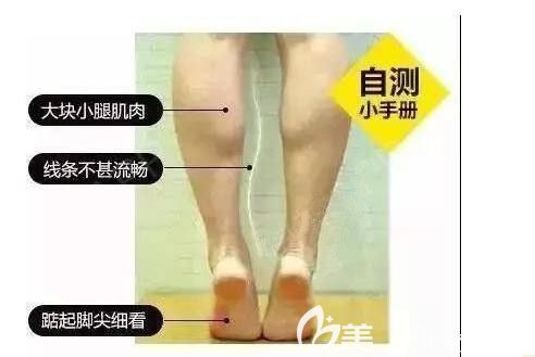 小腿粗壯的肌肉型人士