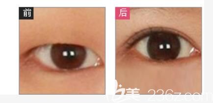 華美官網(wǎng)展示的真人案例圖片