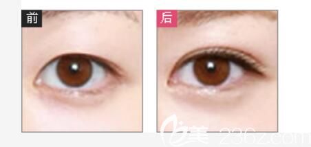 華美真人案例圖片