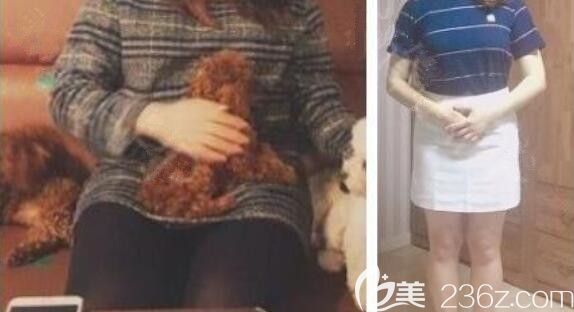 韓國美爾韓整形外科醫(yī)院減肥真人<span style=