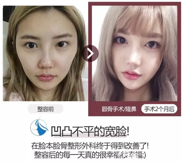 樸用南院長(zhǎng)輪廓真人案例