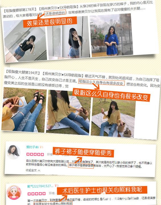 對揚州美貝爾SX導(dǎo)航吸脂評價 對揚州美貝爾SX導(dǎo)航吸脂評價
