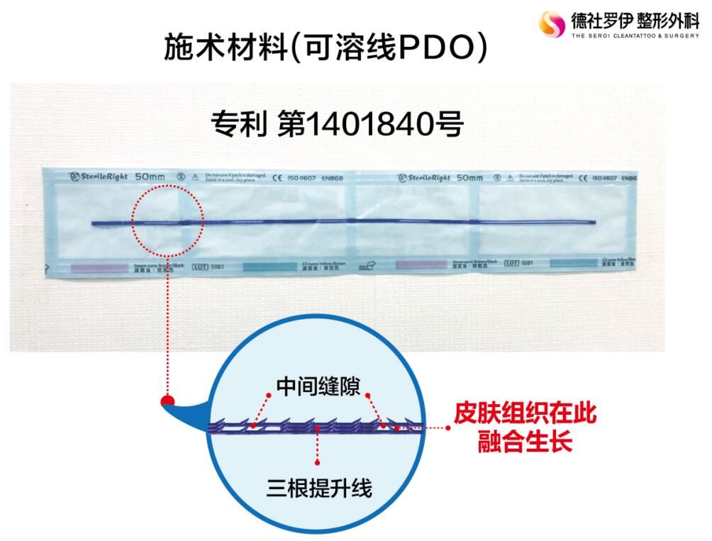 普羅菲耳線雕可溶線PDO核心技術(shù)