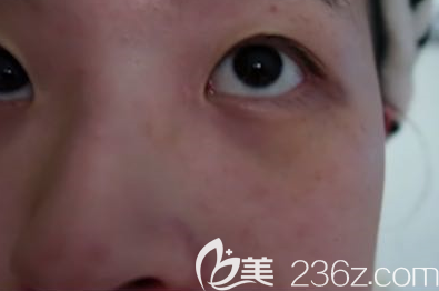 濰坊華美創(chuàng)和做激光祛斑蠻不錯的，而且收費價格也不貴哦