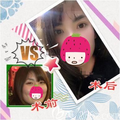 整理宿遷地區(qū)正規(guī)專業(yè)整形醫(yī)院時意外拿到一份宿遷黎明近期整形項目價格表：除皺瘦臉980元眼部綜合4800元