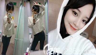 在韓國原辰做全身吸脂手術(shù)后1個(gè)月