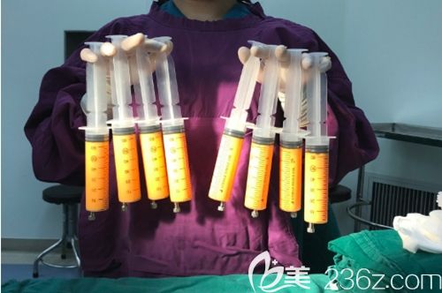 從身體內(nèi)吸出來(lái)的脂肪圖