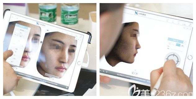 術(shù)前面診<!--<i data=20240703-sp></i>-->醫(yī)生 術(shù)前面診<!--<i data=20240703-sp></i>-->醫(yī)生