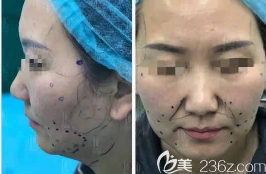 蘭州崔大夫整形<span style= 蘭州崔大夫整形<span style=