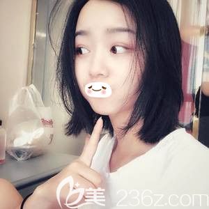 在張家口維多利亞做雙眼皮術(shù)后10天慢慢消腫 在張家口維多利亞做雙眼皮術(shù)后10天慢慢消腫