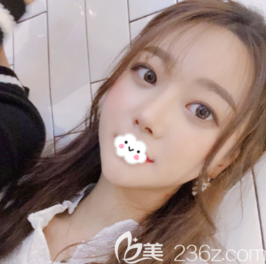 東莞西妃劉波鼻子做的怎么樣 東莞西妃劉波鼻子做的怎么樣