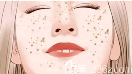 福州瑪恩陳意蕾醫(yī)生科普激光美膚可以保持多久 福州瑪恩陳意蕾醫(yī)生科普激光美膚可以保持多久