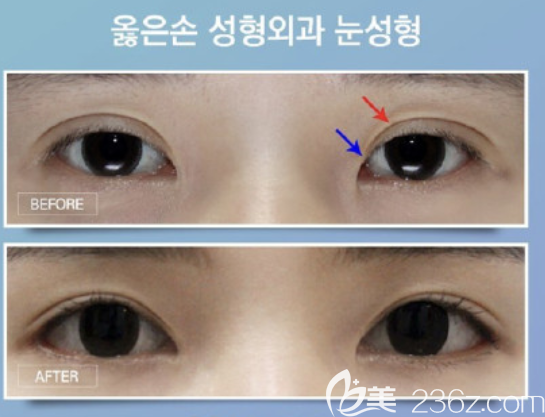 20190618_1560839610941612.png image.png