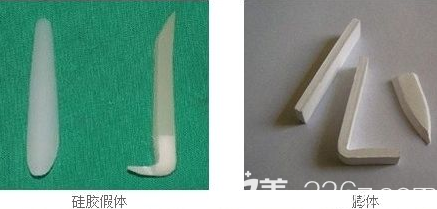 鼻假體硅膠和膨體的樣子