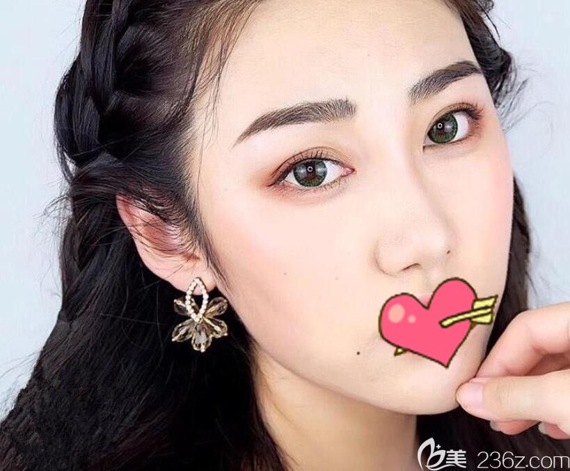 看了閨蜜找合肥韓美整形羅安定做的顴弓顴骨內(nèi)推手術(shù)效果，108天前我讓鄭雪平做了面部吸脂+埋線提升+祛眼袋手術(shù)