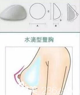 水滴形假體豐胸效果示意圖
