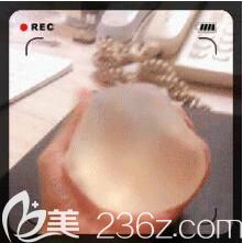 豐胸假體手感測(cè)試