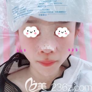 <!--<i data=20240703-sp></i>-->醫(yī)生幫我做鼻部修復(fù)術(shù)后即刻 <!--<i data=20240703-sp></i>-->醫(yī)生幫我做鼻部修復(fù)術(shù)后即刻