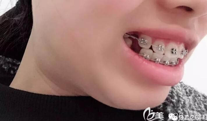 在永華口腔拔牙矯正天 在永華口腔拔牙矯正天